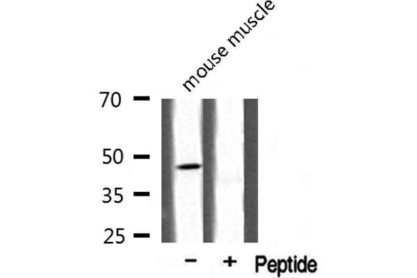 ABHD2 antibody  (Internal Region)