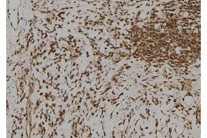 ABIN6273385 at 1/100 staining Human gastric tissue by IHC-P. (RFPL1 antibody  (Internal Region))