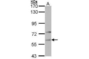 Phenylalanyl-tRNA Synthetase, alpha Subunit (FARSA) 抗体