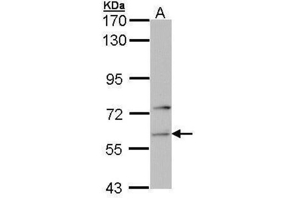 Phenylalanyl-tRNA Synthetase, alpha Subunit (FARSA) 抗体