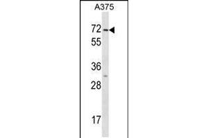 Western blot analysis in A375 cell line lysates (35ug/lane). (Keratin 75 antibody  (N-Term))