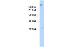 POLR3A antibody used at 1 ug/ml to detect target protein. (POLR3A antibody  (Middle Region))
