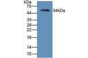Figure. (HAVCR1 antibody  (AA 21-240))