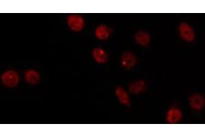 ABIN6266786 staining HT29 by IF/ICC. (MED17 antibody  (Internal Region))