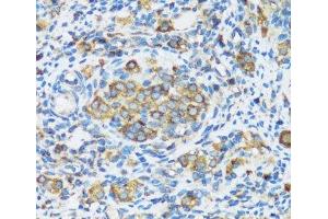 Immunohistochemistry of paraffin-embedded Rat ovary using APOBEC3F Polyclonal Antibody at dilution of 1:100 (40x lens). (APOBEC3F antibody)