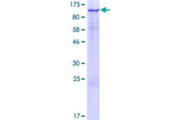 KDM3B Protein (AA 1-759) (GST tag)