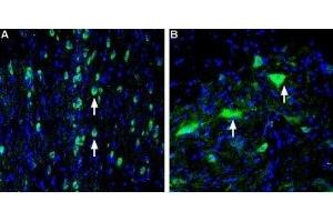 Expression of VAChT in rat medial septum and spinal cord - Immunohistochemical staining of perfusion-fixed frozen rat brain sections using Anti-Vesicular Acetylcholine Transporter (VAChT) Antibody (ABIN7043686, ABIN7044219 and ABIN7044220), (1:400), followed by goat-anti-rabbit-AlexaFluor-488.