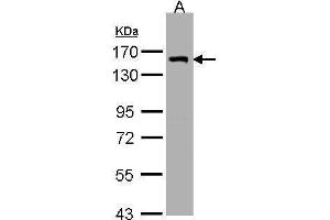 WB Image Sample (30μg whole cell lysate) A:H1299 7. (LIMCH1 antibody  (C-Term))