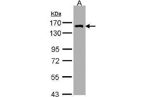 LIMCH1 antibody  (C-Term)