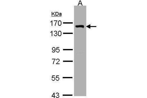 LIMCH1 抗体  (C-Term)