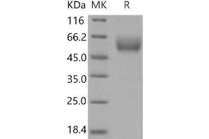 Western Blotting (WB) image for Single Immunoglobulin and Toll-Interleukin 1 Receptor (TIR) Domain (SIGIRR) protein (His tag,Fc Tag) (ABIN7198052) (SIGIRR Protein (His tag,Fc Tag))