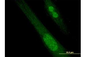 Immunofluorescence of purified MaxPab antibody to SPANXB1 on Hs 181. (SPANXB1 antibody  (AA 1-103))