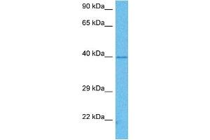 Host:  Mouse  Target Name:  PCBP1  Sample Tissue:  Mouse Brain  Antibody Dilution:  1ug/ml (PCBP1 antibody  (Middle Region))