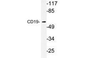 Western blot analysis of CD19 antibody in extracts from COS7 cells. (CD19 antibody)