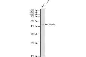 Western blot analysis of extracts of Rat brain, using C9orf72 antibody (ABIN7266391) at 1:1000 dilution. (C9ORF72 antibody  (AA 1-230))