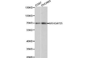 ARHGAP25 抗体  (AA 1-370)
