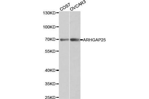 ARHGAP25 antibody  (AA 1-370)