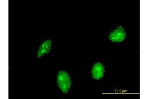 Immunofluorescence of monoclonal antibody to HIC1 on HeLa cell. (HIC1 antibody  (AA 396-453))