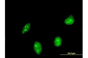 Immunofluorescence of monoclonal antibody to HIC1 on HeLa cell.