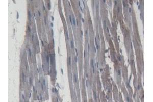 Detection of MMP9 in Rat Cardiac Muscle Tissue using Monoclonal Antibody to Matrix Metalloproteinase 9 (MMP9) (MMP 9 antibody  (AA 226-391))