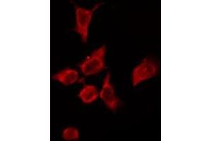 ABIN6276159 staining HeLa by IF/ICC. (OR4P4 antibody  (Internal Region))