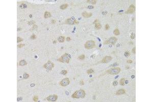 Immunohistochemistry of paraffin-embedded Rat brain using DHRS9 Polyclonal Antibody at dilution of 1:100 (40x lens). (DHRS9 antibody)