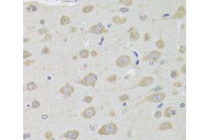 Immunohistochemistry of paraffin-embedded Rat brain using DHRS9 Polyclonal Antibody at dilution of 1:100 (40x lens). (DHRS9 antibody)