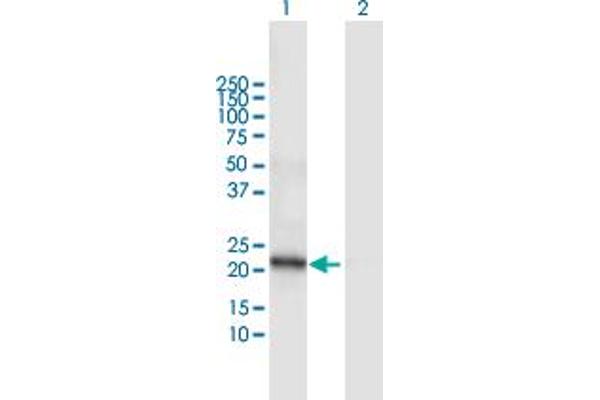 DCAKD Antikörper  (AA 1-231)