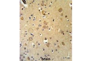 Immunohistochemistry (IHC) image for anti-Leucine Rich Repeat Transmembrane Neuronal 1 (LRRTM1) antibody (ABIN3004292)