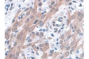 Immunohistochemistry (IHC) image for anti-WW and C2 Domain Containing 1 (WWC1) (AA 847-1094) antibody (ABIN7441667)