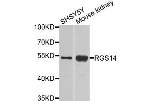 Western blot analysis of extracts of various cells, using RGS14 antibody. (RGS14 antibody)