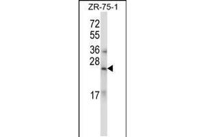 Western blot analysis in ZR-75-1 cell line lysates (35ug/lane). (RLN1,RLN2 antibody  (C-Term))