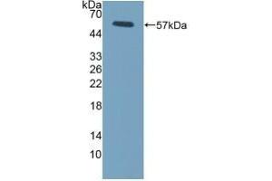 Detection of Recombinant FcgR3A, Mouse using Polyclonal Antibody to Fc Fragment Of IgG Low Affinity IIIa Receptor (FcgR3A) (FCGR3A antibody  (AA 5-240))