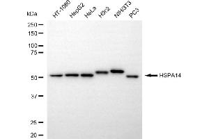 Western blotting analysis using HSPA14 antibody (ABIN7798850).