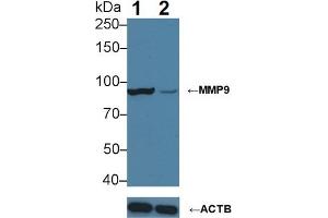 Knockout Varification: Lane 1: Wild-type HepG2 cell lysate; Lane 2: MMP9 knockout HepG2 cell lysate; Predicted MW: 76kDa Observed MW: 90kDa Primary Ab: 3µg/ml Mouse Anti-Human MMP9 Antibody Second Ab: 0. (MMP 9 antibody  (AA 213-399))