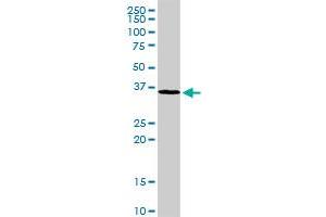 MAD2L1BP antibody  (AA 1-306)