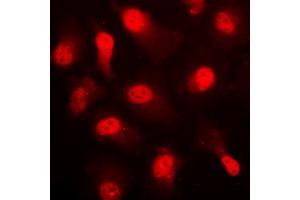 Immunofluorescent analysis of AMPK alpha 1 (pS496) staining in HUVEC cells. (PRKAA1 antibody  (C-Term, pSer496))