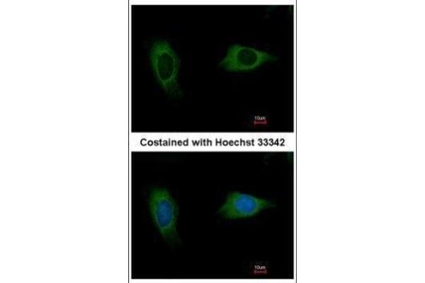 EVC2 antibody  (C-Term)