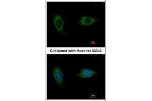 ICC/IF Image Immunofluorescence analysis of methanol-fixed HeLa, using EVC2, antibody at 1:500 dilution. (EVC2 antibody  (C-Term))