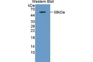 Detection of Recombinant ELA3A, Human using Polyclonal Antibody to Elastase 3A (ELA3A) (Elastase 3A antibody  (AA 16-270))
