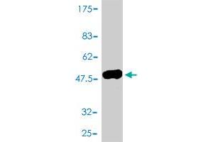 Western Blot detection against Immunogen (47. (VSNL1 antibody  (AA 1-191))