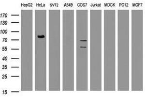 Image no. 2 for anti-HBS1-Like (HBS1L) (AA 1-242) antibody (ABIN1490627) (HBS1L antibody  (AA 1-242))