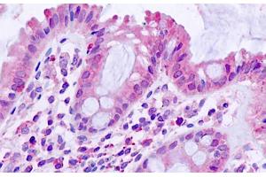 ABIN768623 (5µg/ml) staining of paraffin embedded Human Small Intestine. (TGFBR1 antibody  (AA 50-63))