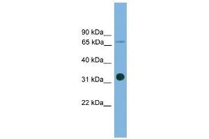 Western Blot showing SLC5A4 antibody used at a concentration of 1-2 ug/ml to detect its target protein. (SLC5A4 antibody  (Middle Region))
