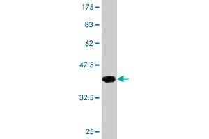 Western Blot detection against Immunogen (35. (GBA antibody  (AA 146-235))