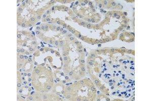 Immunohistochemistry of paraffin-embedded Mouse kidney using CHMP1B Polyclonal Antibody at dilution of 1:100 (40x lens).