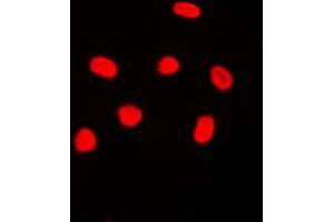 Immunofluorescent analysis of Histone H4 staining in MCF7 cells. (Histone H4 antibody  (N-Term))
