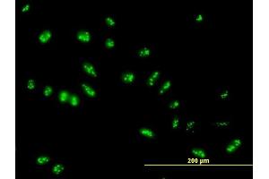 Immunofluorescence of purified MaxPab antibody to LYAR on HeLa cell. (LYAR antibody  (AA 1-379))