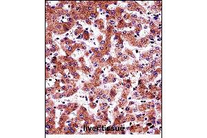 BP Antibody (N-term) (ABIN657686 and ABIN2846678) immunohistochemistry analysis in formalin fixed and paraffin embedded human liver tissue followed by peroxidase conjugation of the secondary antibody and DAB staining.