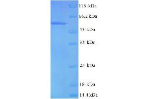 SDS-PAGE (SDS) image for Family with Sequence Similarity 82, Member A2 (FAM82A2) (AA 1-470), (full length) protein (His tag) (ABIN5711565) (RMDN3 Protein (AA 1-470, full length) (His tag))